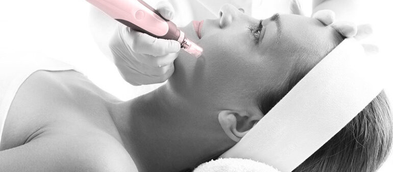 Dermapen Tychy